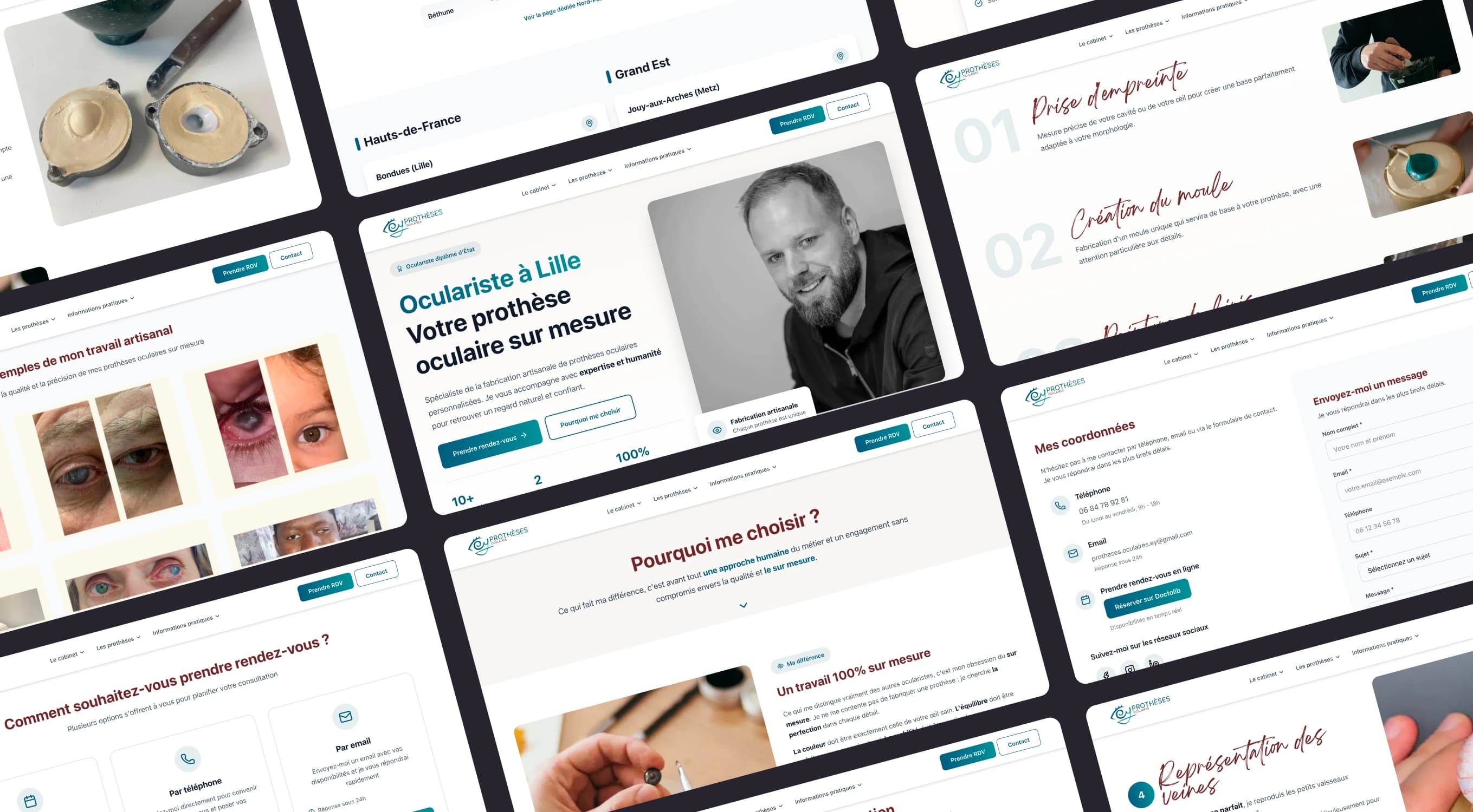 Site Cyrille Ey — oculariste diplômé d'État, prothèses oculaires sur-mesure